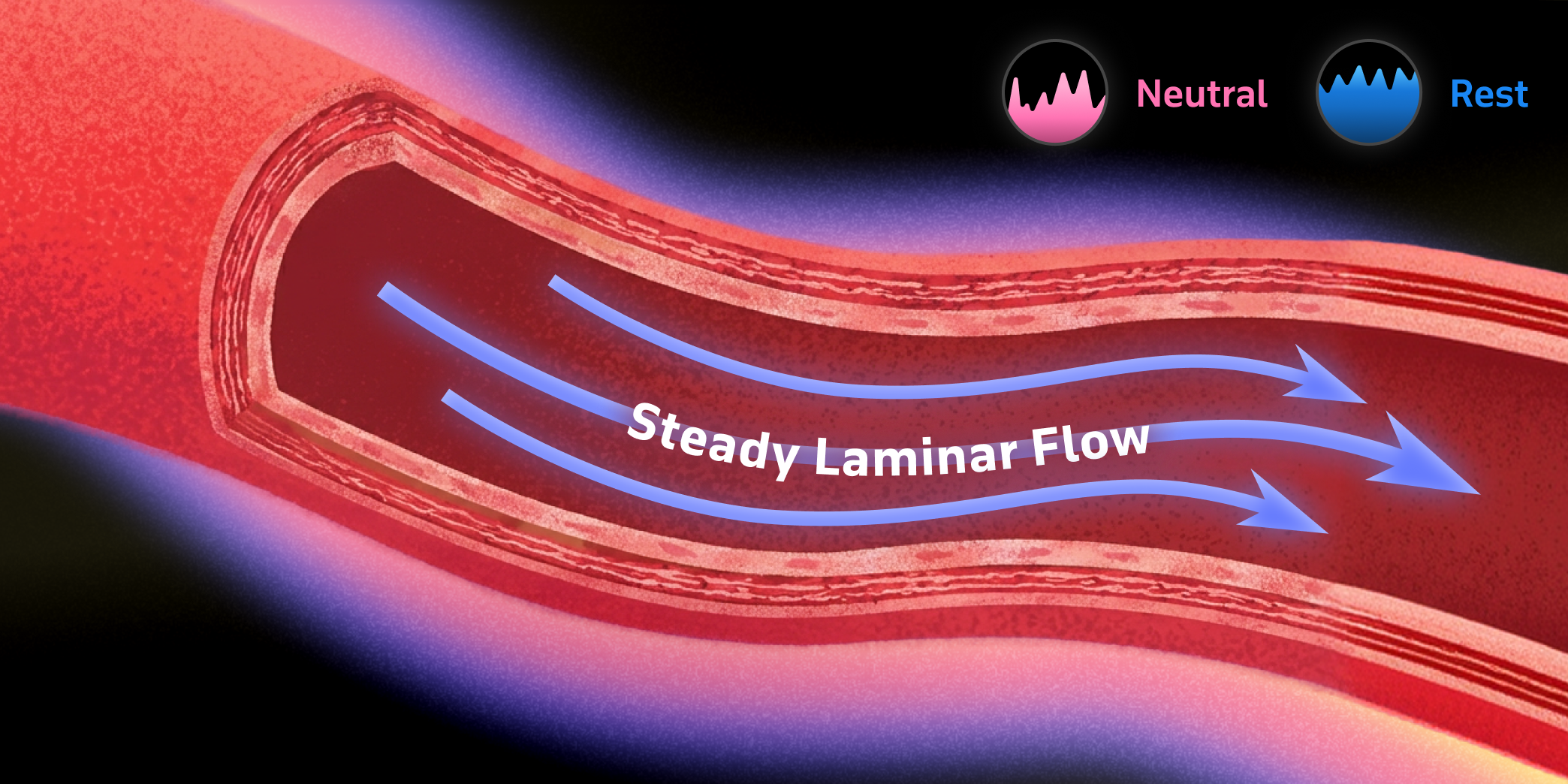 Smooth, laminar blood flow through an open, dilated blood vessel