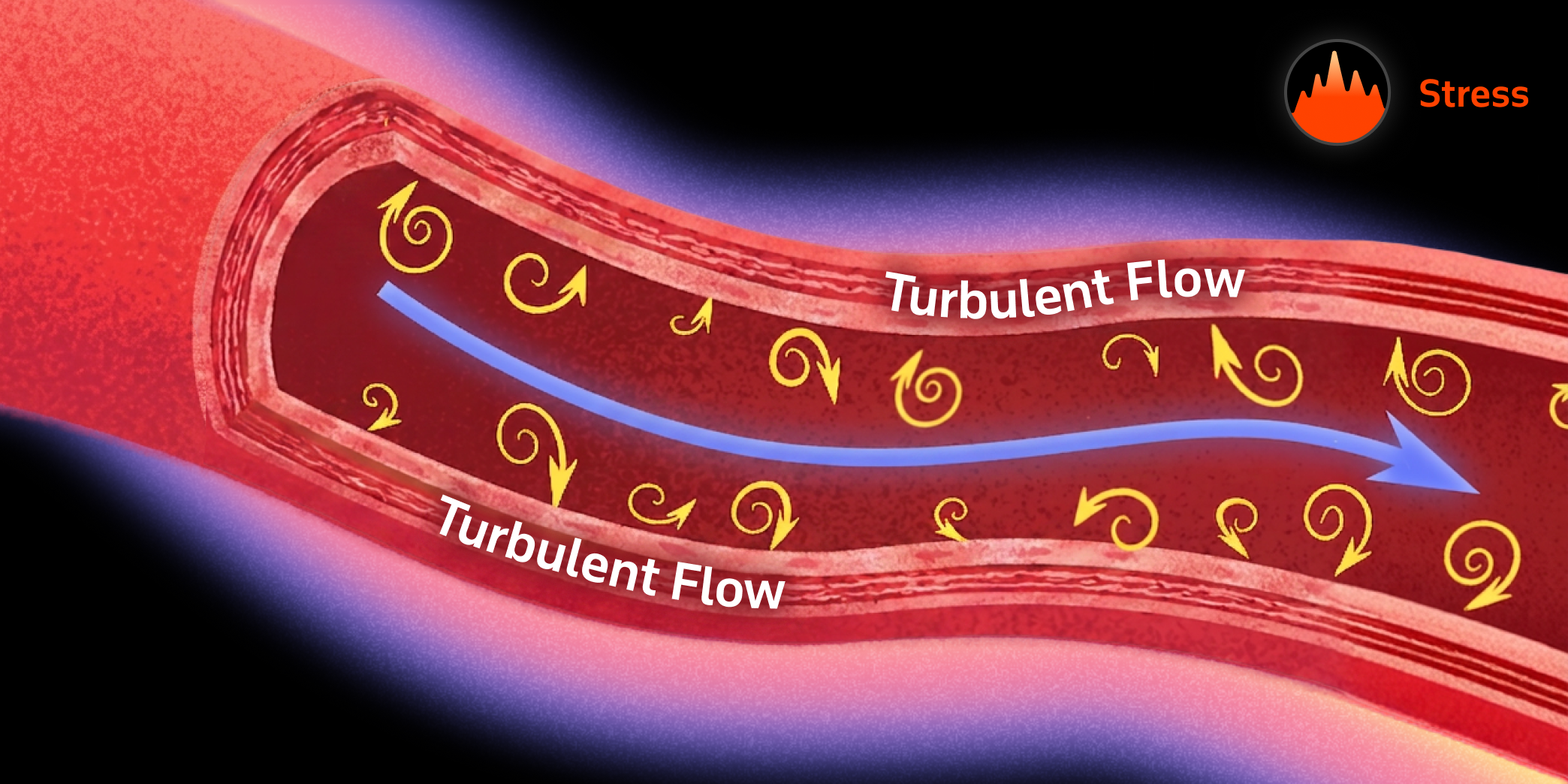 Turbulent blood flow forced through a constricted vessel