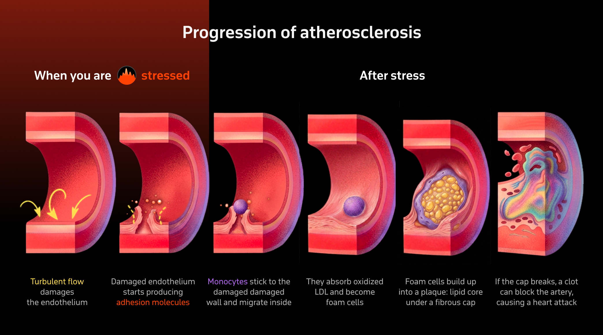 Endothelial damage and the start of plaque buildup from turbulent flow