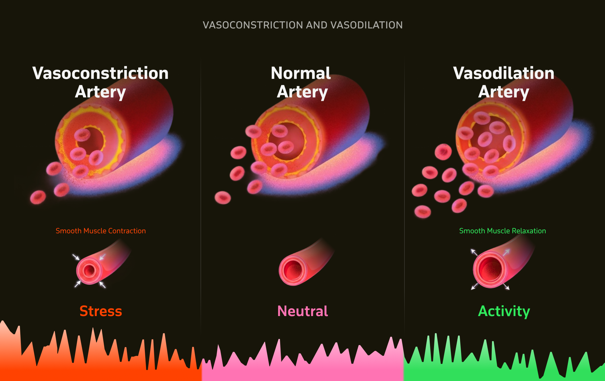 Reduced blood flow to the heart during stress-induced vasoconstriction